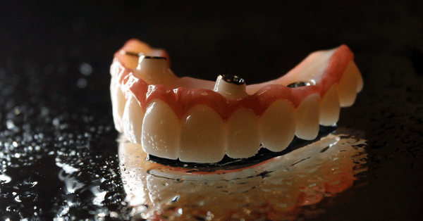 implant dentist Acworth