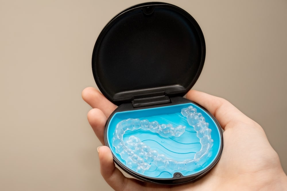Spark and SureSmile® Clear Aligners