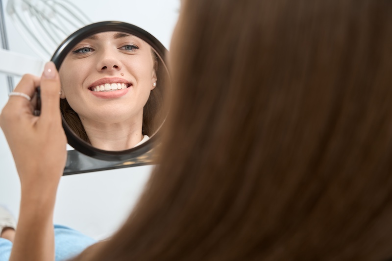 Acworth smile makeover