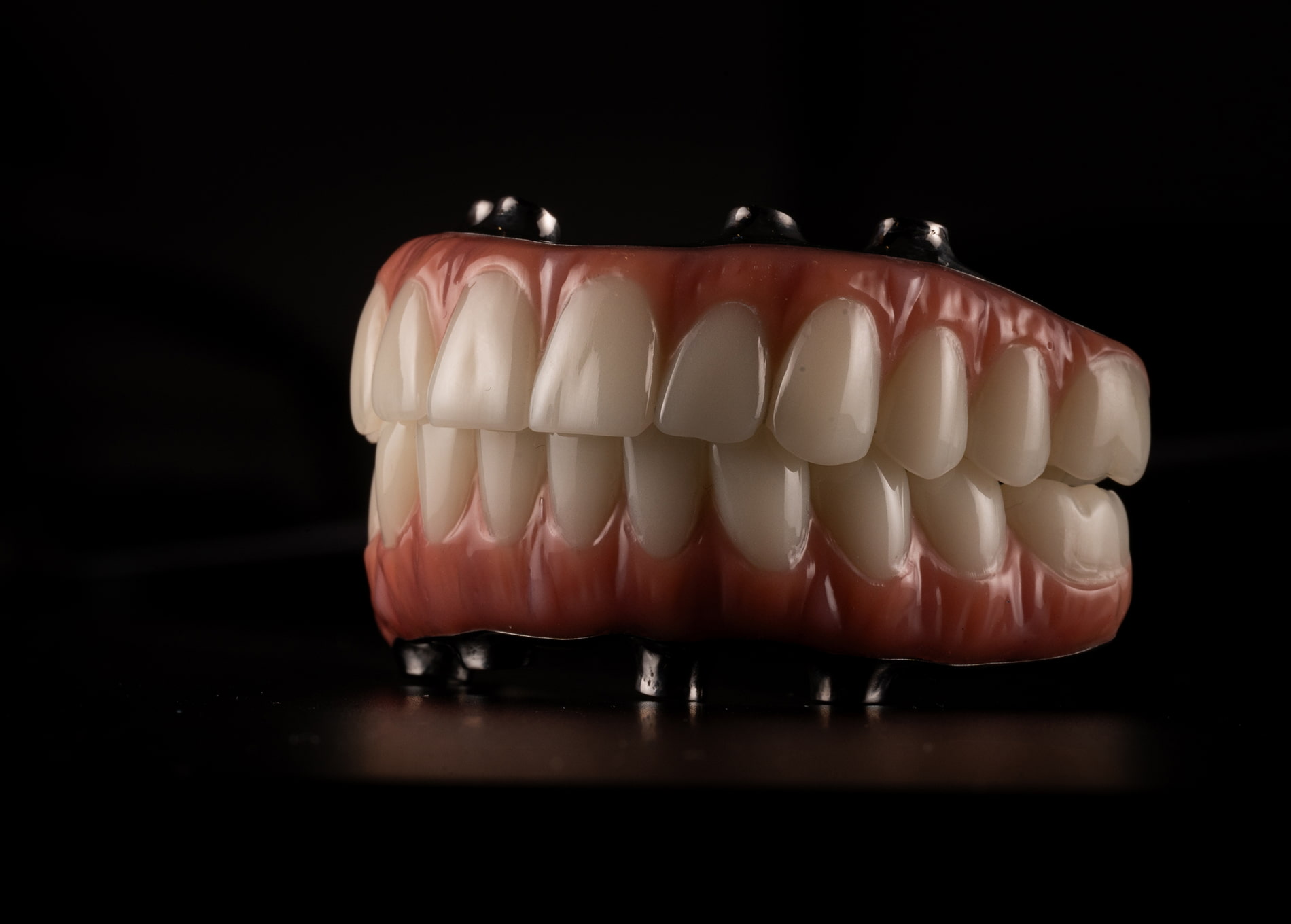 full mouth dental implants in Acworth