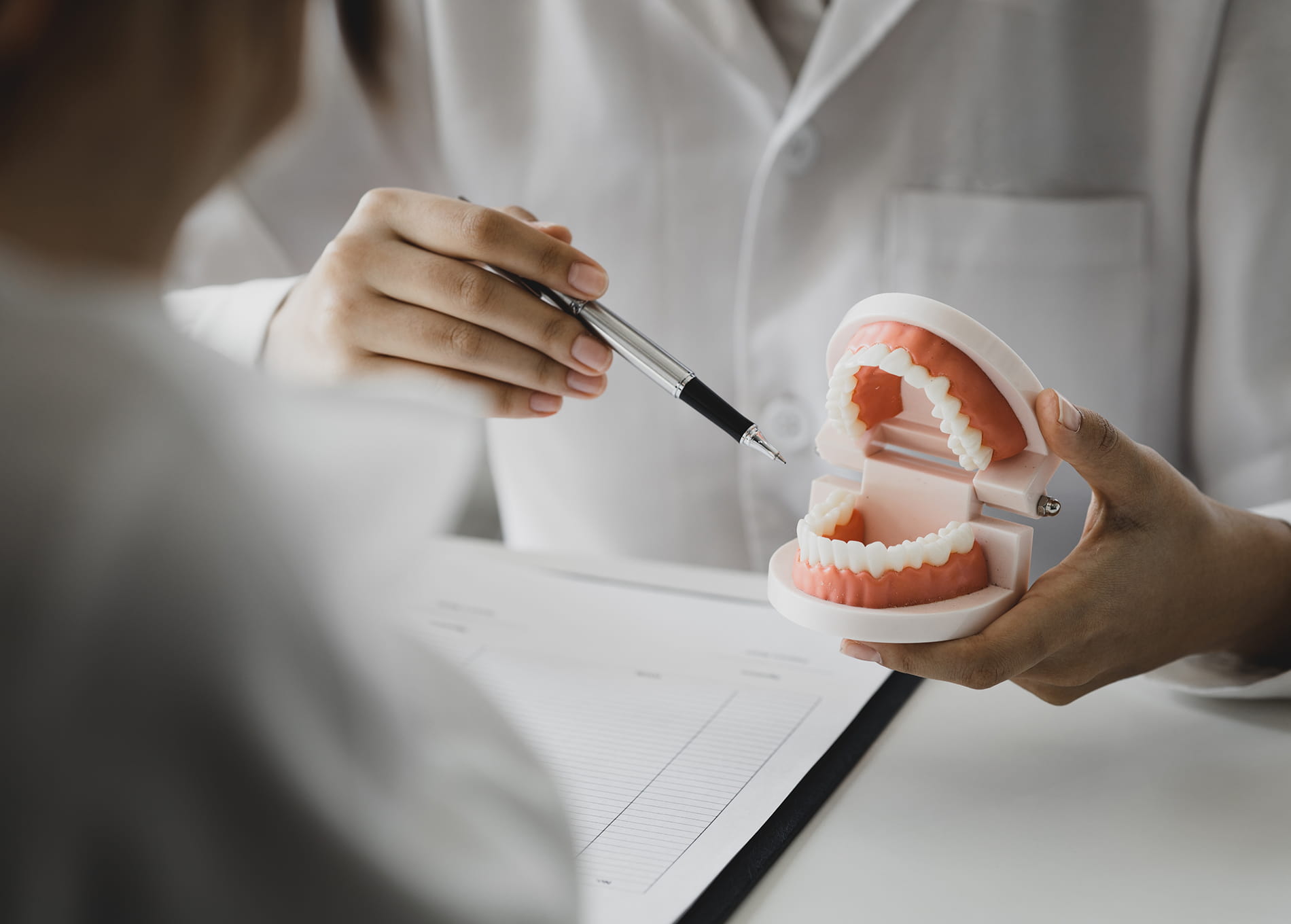 full mouth implants services